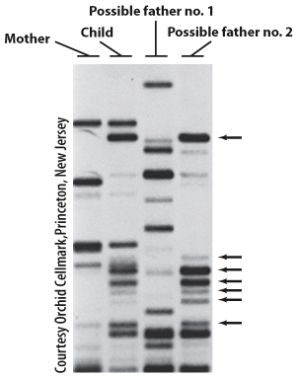 <strong>What does this figure communicate? </strong> A)The child is related to father number one B)The child is related to father number two C)The child is related to the mother only D)The child is related to both fathers