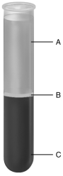 Using the figure above, answer the following questions. The blood component indicated by A is the ________.