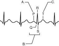 The figure above shows a normal ECG recording. Match each part, A, B, or C, of the recording to its description. -represents the stimulus for heart contraction traveling across the atria