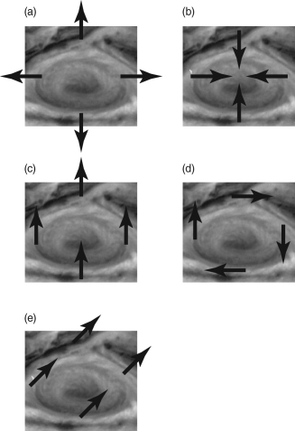 <strong>If you tracked the motion of the clouds near Jupiter's Great Red Spot, which of the following diagrams shows the correct motion you would observe? </strong> A) A B) B C) C D) D E) E