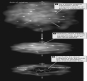 <strong>Consider the figure shown below. At which point in time does the collapsing cloud have the greatest angular momentum? </strong> A) 1 B) 2 C) 3 D) 1 and 2, because the protostar has not yet formed. E) The cloud has the same angular momentum at each point in time.