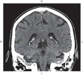 <strong>The figure below illustrates which of the following imaging planes? </strong> A) Axial B) Coronal C) Sagittal D) Oblique