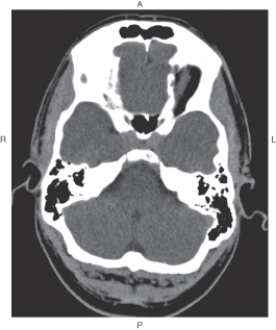 <strong>The figure below illustrates which of the following imaging planes? </strong> A) Axial B) Coronal C) Sagittal D) Oblique