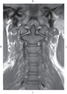 <strong>The figure below illustrates which of the following imaging planes? </strong> A) Axial B) Coronal C) Sagittal D) Oblique