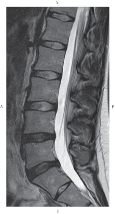 <strong>The figure below illustrates which of the following imaging planes? </strong> A) Axial B) Coronal C) Sagittal D) Oblique