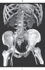 <strong>The figure below is an example of which of the following? </strong> A) Multiplanar reformation B) Shaded surface display C) Maximum intensity projection D) Volume rendering