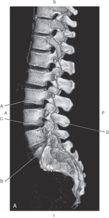 <strong>Questions 44 through 47 refer to the figure below of a 3D CT of the lumbar spine, lateral view. Which arrow points to the body of L3?</strong> A) A B) B C) C D) D