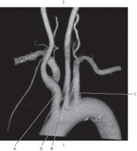 <strong>Questions 22 through 25 refer to the figure below of a 3D CT of the aortic arch. In the figure below an a sagittal MR of the breast,which arrow points to the glandular tissue? </strong> A) A B) B C) C D) D
