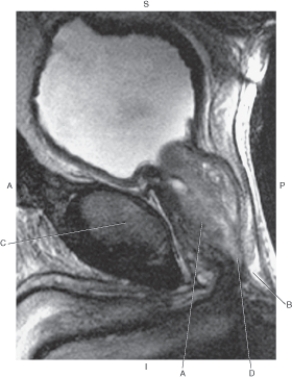 <strong>In the figure below of a sagittal MRI of the male pelvis,which arrow points to the prostate gland? </strong> A) A B) B C) C D) D