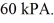 <strong>The temperature of an ideal gas in a sealed 0.40- rigid container is reduced from 350 K to The final pressure of the gas is The molar heat capacity at constant volume of the gas is 28.0 J/mol · K.The heat absorbed by the gas is closest to</strong> A)-24 kJ. B)-31 kJ. C)24 kJ. D)31 kJ. E)0.00 kJ.