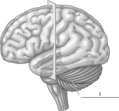<strong>Refer to the figure below, and then answer the question that follows. The part of the brain indicated by a 1 corresponds to the:</strong> A)thalamus. B)hypothalamus. C)medulla oblongata. D)cerebellum.