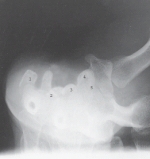 <strong>Which carpal bone is 1? </strong> A)Scaphoid B)Trapezium C)Hamate D)Pisiform