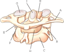 The body of C2 is labeled _____.