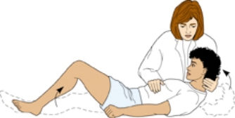 The nurse is preparing to conduct an assessment of a patient's neurological status. What is the nurse assessing for in this diagram?
