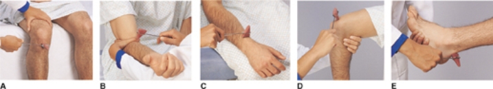 The nurse is planning to assess a patient's brachioradialis reflex. Place an X on the picture that represents the technique the nurse will use to test this reflex.