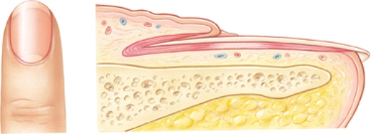 A patient has a history of paronychia. Place an X on the area of the fingernail that becomes inflamed in paronychia.