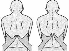 <strong>When performing an assessment of the patient's respiratory system, the nurse uses the following illustrated technique to evaluate </strong> A) chest expansion. B) tactile fremitus. C) accessory muscle use. D) diaphragmatic excursion.