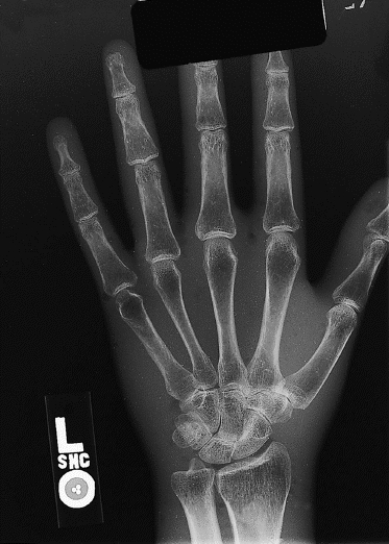 What projection and anatomy of interest are demonstrated in Figure 19-3?