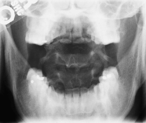 <strong>What is wrong with Figure 19-8? </strong> A) There is too much density on the image. B) The anatomy of interest is rotated. C) Image contrast is too low. D) An artifact is present on the image.