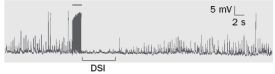 Figure Q10-23 shows an example of endocannabinoid modulation of synaptic strength after high frequency stimulation (indicated by the horizontal bar above the large amplitude activity) to the presynaptic CA3 neurons. What would happen to the response if the CB1 receptors were blocked? Figure Q10-23 (a) The frequency of spontaneous IPSPs immediately after the stimulus would decrease compared to their frequency prior to the stimulation. (b) The frequency of spontaneous IPSPs immediately after the stimulus would increase compared to their frequency prior to the stimulation. (c) The frequency of the spontaneous IPSPs would not change immediately after the stimulus compared to the frequency of spontaneous IPSPs prior to the stimulation. (d) The amplitude of the spontaneous IPSPs would increase immediately after the stimulus, compared to their amplitude prior to the stimulation. (e) The amplitude of the spontaneous IPSPs would decrease immediately after the stimulus, compared to their amplitude prior to the stimulation.