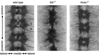 There are three Robo genes (Robo, Robo2, and Robo3) encoding receptors for Slit, which acts as a midline repellant. In homozygous Slit mutant embryos, all axons collapse at the midline, while in homozygous Robo mutant embryos, axons re-cross the midline, resulting in thinner longitudinal tracts and thicker commissures (Figure Q7-8). Figure Q7-8 What would you expect the ventral nerve cord phenotype of a triple Robo mutant (loss of function of all three Robo genes) to be? Briefly explain your reasoning.
