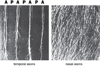 Temporal and nasal RGC axons behave very differently in the stripe assay with alternating anterior and posterior tectal membranes, as seen in Figure Q5-4. Figure Q5-4 A. What possible interpretations can be drawn from the selective growth of temporal RGC axons in this assay? B. What possible interpretations can be drawn from the indiscriminate growth of nasal RGC axons in this assay?