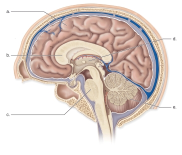 <strong>Figure: This figure shows the anatomy of the human brain.What does b represent?</strong> A)The thalamus B)The cerebellum C)The corpus callosum D)The cerebrum E)The pons