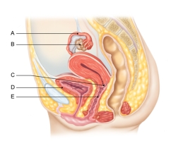 <strong>In the figure shown here,which of the following is the cervix? </strong> A) A B) B C) C D) D E) E