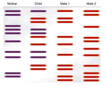 <strong>DNA fingerprinting may be used to establish paternity.Analyze the banding pattern to determine the father of the child. </strong> A)Male 1 B)Male 2