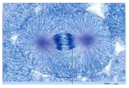 <strong>What phase of mitosis is pictured? </strong> A)prophase B)prometaphase C)metaphase D)anaphase E)telophase