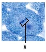 <strong>What phase of mitosis is pictured? </strong> A)prophase B)prometaphase C)metaphase D)anaphase E)telophase