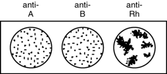 <strong>What blood type does an individual have according to the blood typing results illustrated in this figure? </strong> A) O positive B) A negative C) B positive D) AB negative E) O negative
