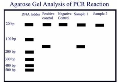 <strong> A PCR amplification was done on a positive control containing the template DNA, a negative control without the template DNA and two samples. Oligonucleotide primers of 21 base pairs were used, and the expected amplicon product is about 160 base pairs. Observe the agarose gel electrophoresis done on the amplicons, and give the most appropriate interpretations.</strong> A)The assay must be repeated because the positive control has more than one amplicon. B)The assay must be repeated because the amplicon is not the right size. C)The assay must be repeated because there is evidence of primer dimer formation. D)Sample 1 is positive for the template DNA, and sample 2 is negative for the template DNA. E)The assay must be repeated because the negative control is not negative.