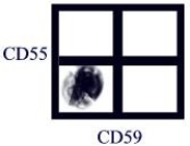 <strong> A flow cytometry analysis was done as shown in the figure with the gate set on red blood cells. What is the most likely interpretation of the analysis?</strong> A)The red cells were all lysed in the preparation. B)The gate is contaminated with white blood cells. C)The patient may have a glucose- 6- phosphate dehydrogenase deficiency. D)The patient may have paroxysmal nocturnal hemoglobinuria. E)The reticulocyte population is elevated.