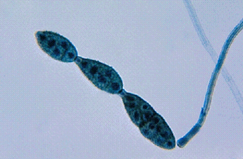 <strong>Identify the following: </strong> A) Candida albicans B) Alternaria spp. C) Mucor spp. D) Pseudoallescheria boydii