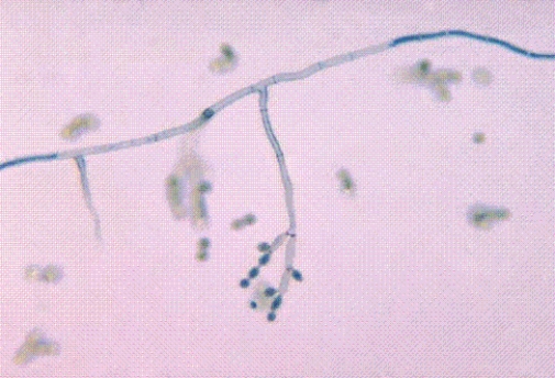 <strong>Identify the following: </strong> A) Cladosporium spp. B) Candida spp. C) Coccidioides immitis D) Cryptococcus neoformans