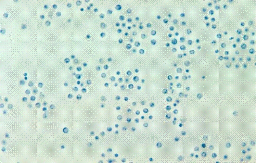 <strong>Identify the following: </strong> A) Coccidioides immitis B) Blastomyces dermatitidis C) Cryptococcus neoformans D) Candida albicans