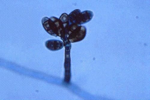 <strong>Identify the following: </strong> A) Mucor spp. B) Rhizopus spp. C) Alternaria spp. D) Curvularia spp.