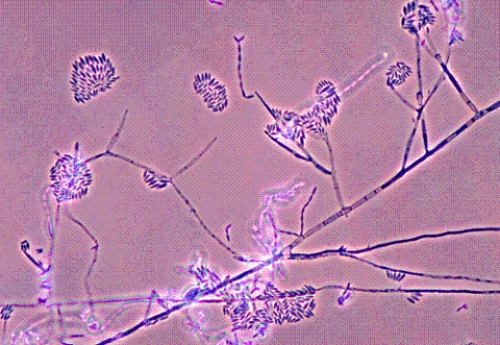 <strong>Identify the following: </strong> A) Sporothrix schenckii B) Fusarium spp. C) Mucor spp. D) Geotrichum spp.