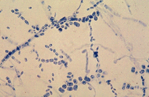 <strong>Identify the following: </strong> A) Mucor spp. B) Penicillium spp. C) Geotrichum spp. D) Alternaria spp.