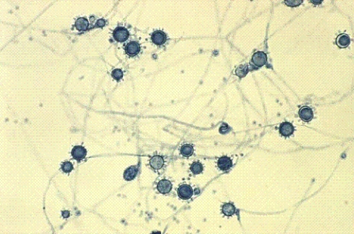 <strong>Identify the following: </strong> A) Histoplasma capsulatum B) Toxoplasma gondii C) Microsporum tonsurus D) Paracoccidioides brasiliensis