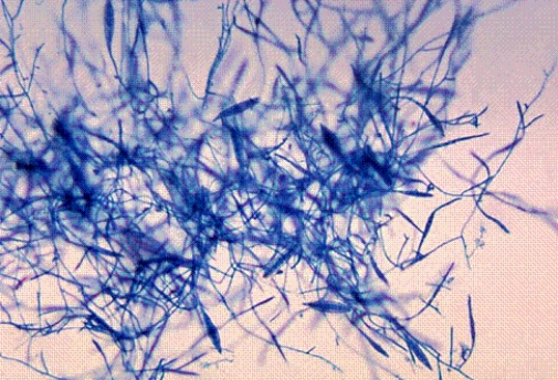 <strong>Identify the following: </strong> A) Trichophyton spp. B) Mucor spp. C) Microsporum canis D) Blastomyces dermatitidis