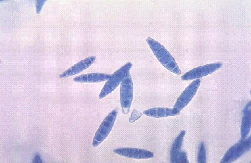<strong>Identify the following: </strong> A) Trichophyton rubrum B) Epidermophyton audouinii C) Fonsecaea compacta D) Microsporum gypseum