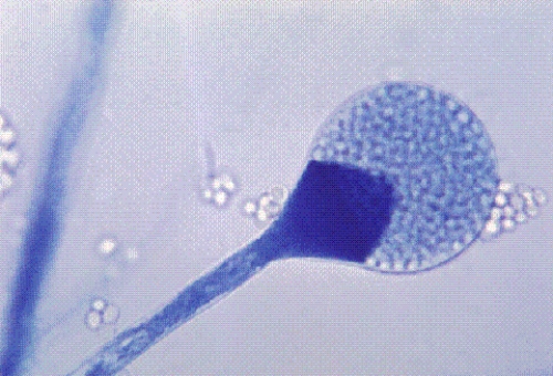 <strong>Identify the following: </strong> A) Mucor spp. B) Microsporum spp. C) Sporothrix schenckii D) Malassezia furfur