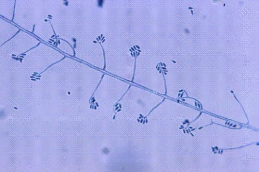 <strong>Identify the following: </strong> A) Trichosporon boydii B) Sporothrix schenckii C) Trichophyton rubrum D) Microsporum canis