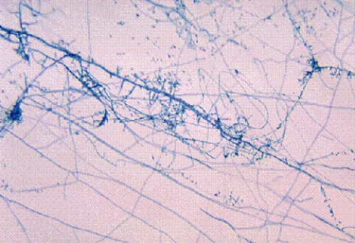 <strong>Identify the following: </strong> A) Microsporum canis B) Sporothrix schenckii C) Aspergillus fumigatus D) Trichophyton mentagrophytes