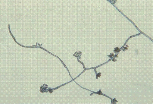 <strong>Identify the following: </strong> A) Malassezia furfur B) Mucor spp. C) Phaeoannellomyces werneckii D) Microsporum canis