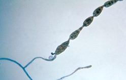 <strong>This organism was isolated from a sinus aspirate of a patient with chronic sinusitis and respiratory allergies.Identify the organism shown below. </strong> A)Candida albicans B)Alternaria spp. C)Mucor spp. D)Pseudallescheria boydii