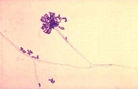 <strong>A bone marrow transplant patient develops an abrupt fever with respiratory distress.Despite treatment with antifungal medications, the patient dies on the fifth day.The following organism was isolated from both sputum and blood cultures.Identify the organism shown below. </strong> A)Rhizopus spp. B)Mucor spp. C)Histoplasma capsulatum D)Aspergillus spp.