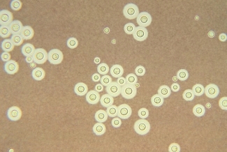 <strong>A Seattle woman with HIV complains of headaches and also displays some memory loss.Because of her history, the physician collects cerebrospinal fluid (CSF) and sends it to the laboratory for analysis.The following image is seen using India ink stain.What is the most likely identification of this organism? </strong> A)Coccidioides immitis B)Blastomyces dermatitidis C)Cryptococcus gattii D)Candida albicans